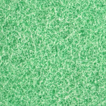 Phosphate Removal Pad Close-Up