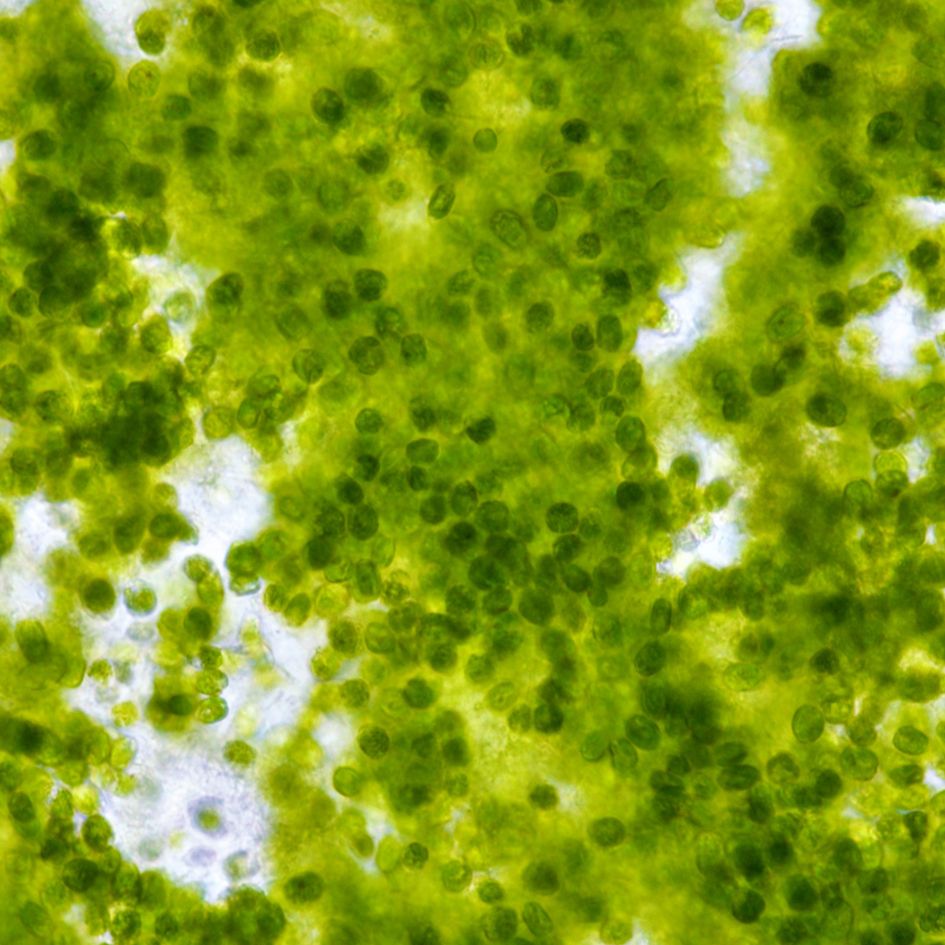 phytoplanktoncloseup_1_1_1_1_2_1